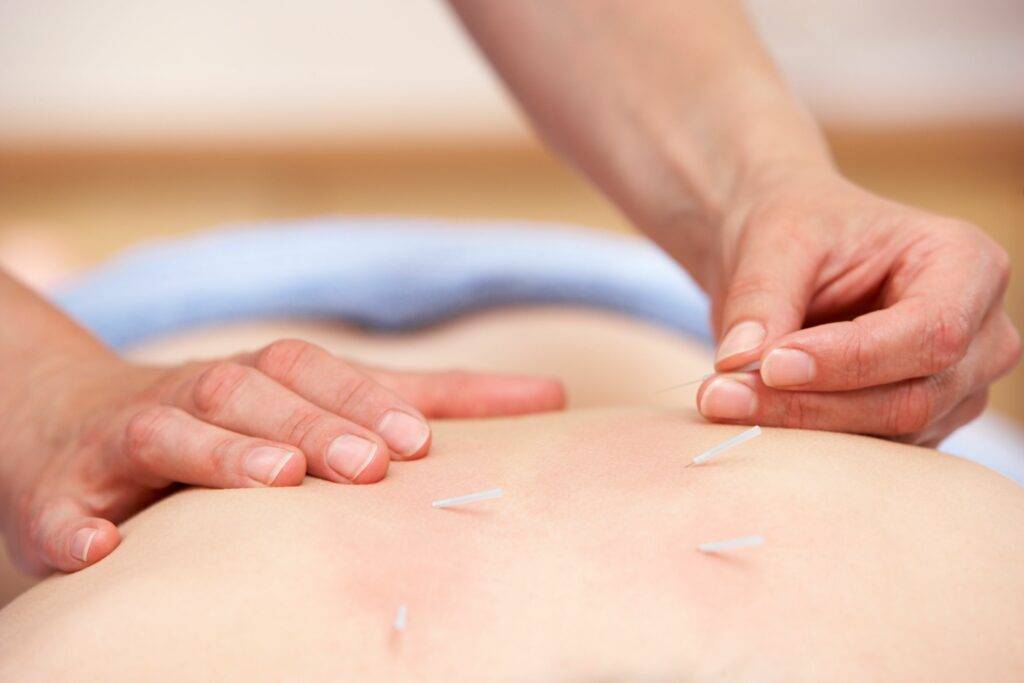 WELLBEING ACUPUNCTURE