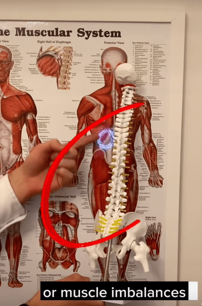 Understanding Back Spasms: A Deep Dive from a Chiropractor’s Lens
