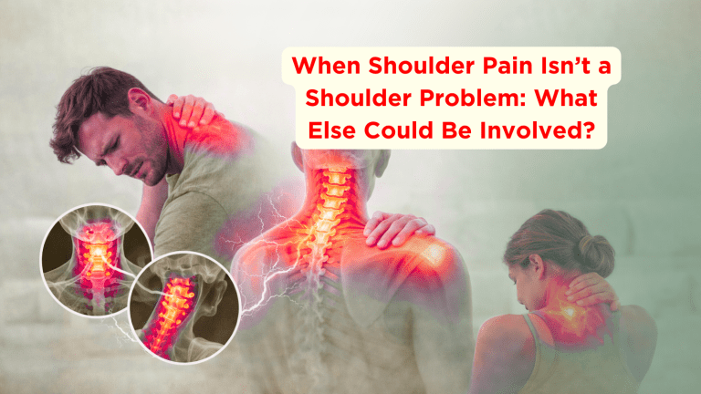 When Shoulder Pain Isn’t a Shoulder Problem: What Else Could Be Involved?