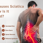 What Causes Sciatica and How Is It Assessed? What Causes Sciatica and How Is It Assessed?